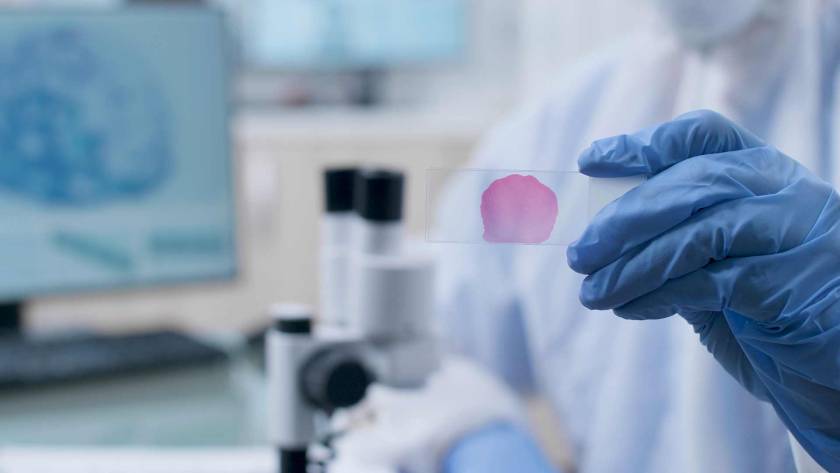 Stem Cell Therapy and Steroid Injections