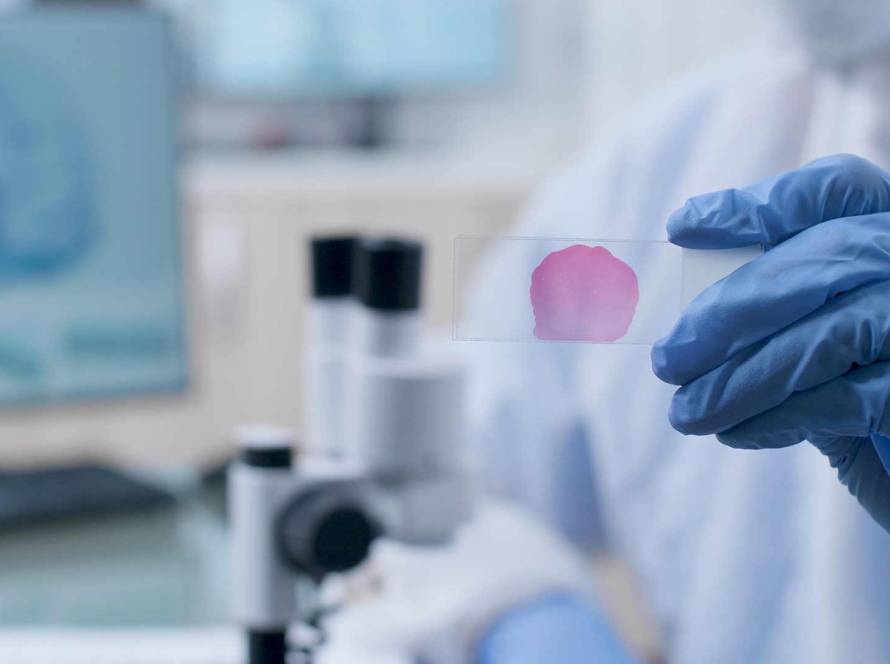 Stem Cell Therapy and Steroid Injections