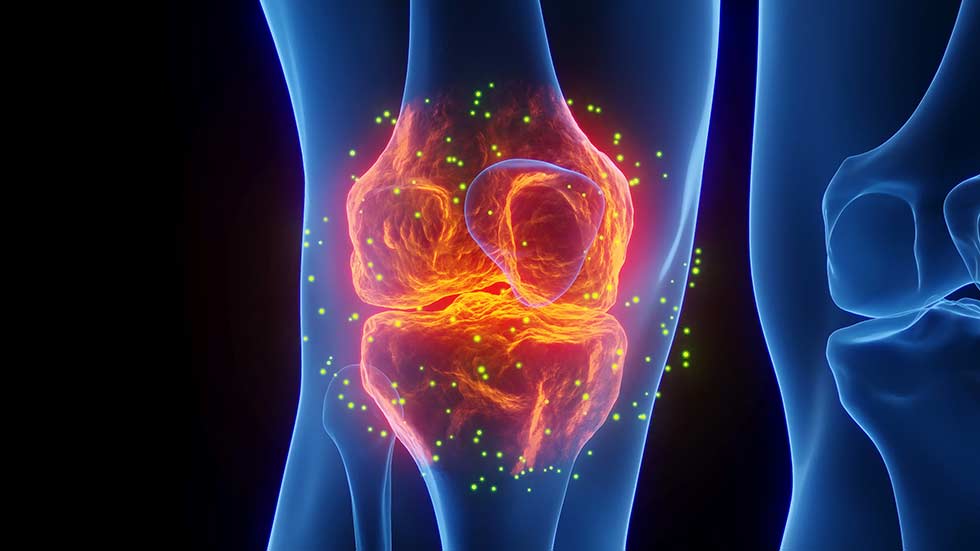 Knee Stem CEll Therapy